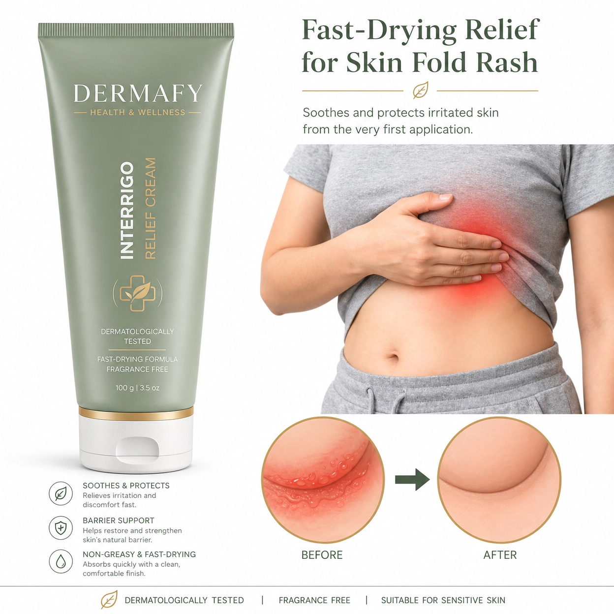 Dermafy Interrigo Relief Cream — fast-drying relief, before and after results